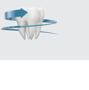 dente mancante da sostituire